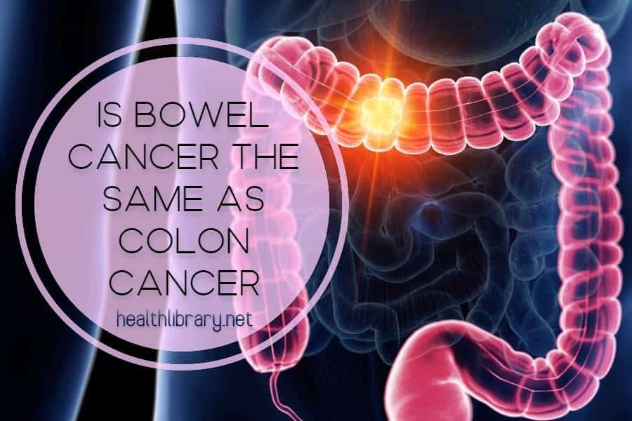 Colon Versus Bowel Cancer: What Is the Difference? · HealthLibrary.net